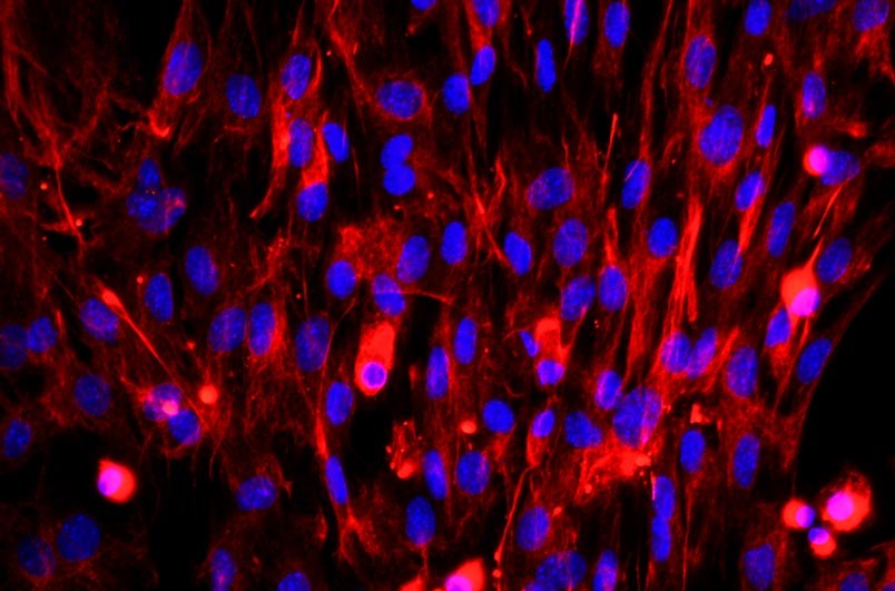 小鼠胚胎成纖維細(xì)胞主圖