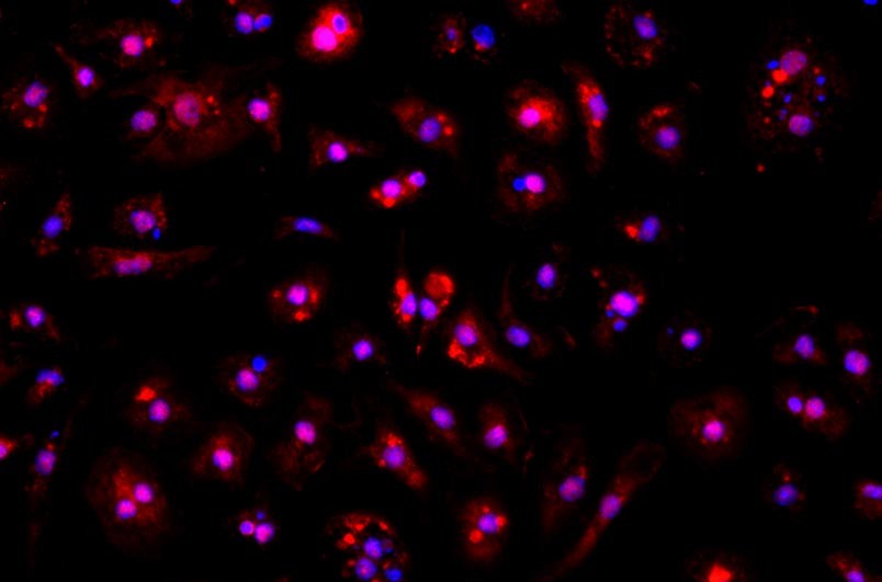 小鼠骨髓來源內(nèi)皮祖細(xì)胞主圖