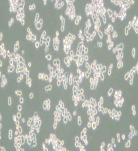 COLO-320DM人結(jié)直腸腺癌細(xì)胞主圖