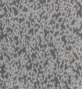 Daudi人Burkitt's淋巴瘤細(xì)胞主圖