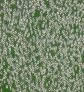 DB-彌漫大B細胞淋巴瘤細胞主圖