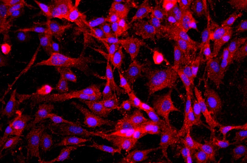 小鼠海綿體內(nèi)皮細(xì)胞主圖