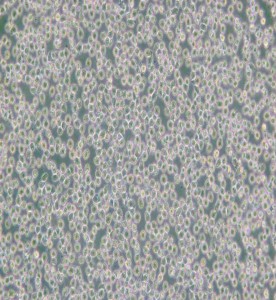 HAL-01人淋巴細(xì)胞白血病細(xì)胞主圖