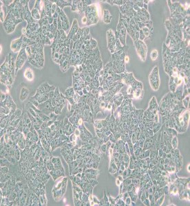 HCT-8 [HRT-18]人回盲腸癌細(xì)胞主圖