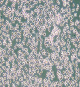 JM人T淋巴細(xì)胞白血病細(xì)胞主圖