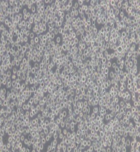 Jurkat clone A3[A3]人T淋巴細(xì)胞白血病細(xì)胞主圖