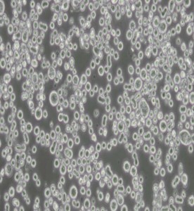 KATO III[KATO 3]人胃癌細(xì)胞主圖