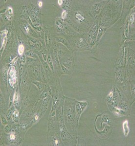 MKN-7[MKN7; MKN7]人胃癌細(xì)胞主圖