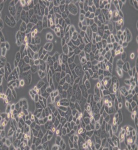 MDA-MB-468人乳腺癌細(xì)胞(DMEM)主圖
