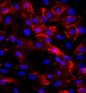 人臍靜脈內(nèi)皮細(xì)胞主圖