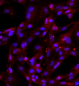 人關節(jié)軟骨細胞主圖