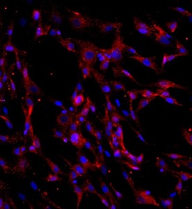 人骨髓間充質(zhì)干細(xì)胞主圖