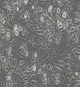 HeLa人宮頸癌細(xì)胞主圖