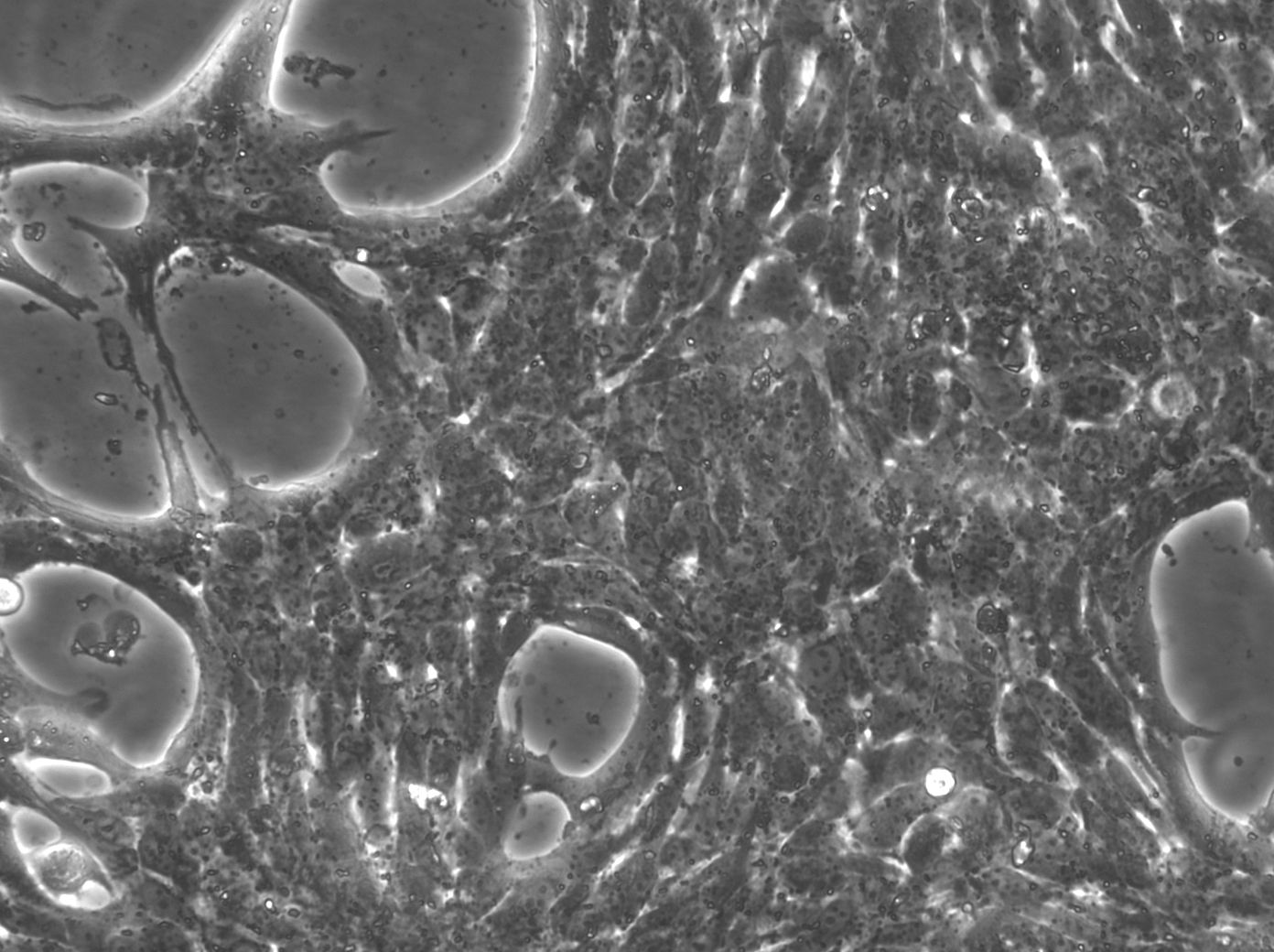 HEP-53.4 小鼠肝癌細(xì)胞主圖