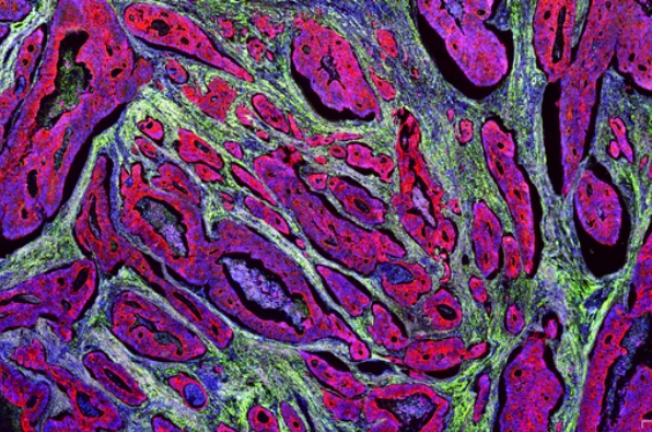 免疫熒光四標(biāo)五色染色主圖
